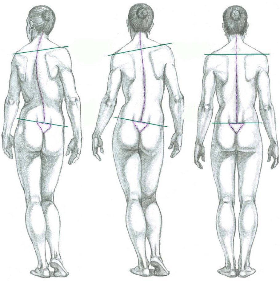 Контрапост Рыжкин
