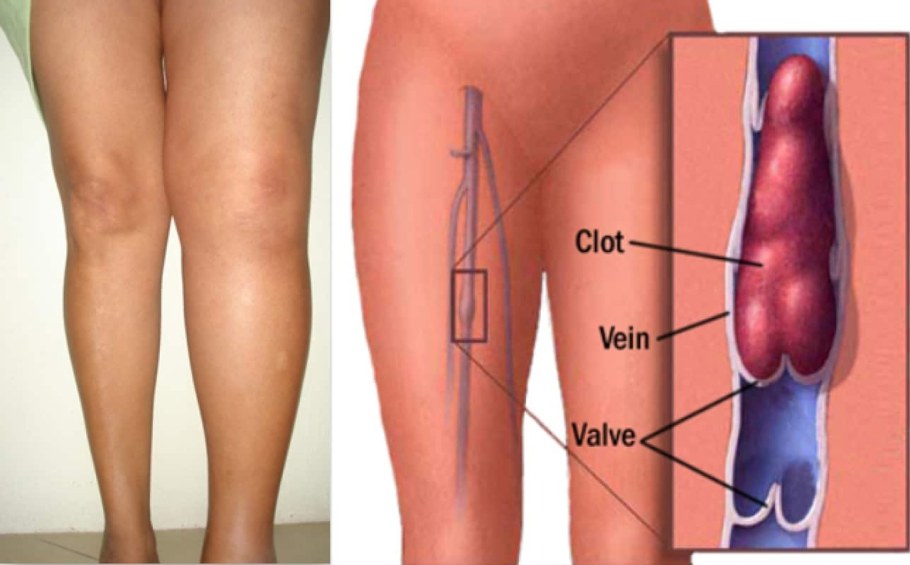 Дакота Скай порноактриса