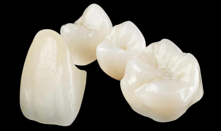 Безметалловые коронки Emax