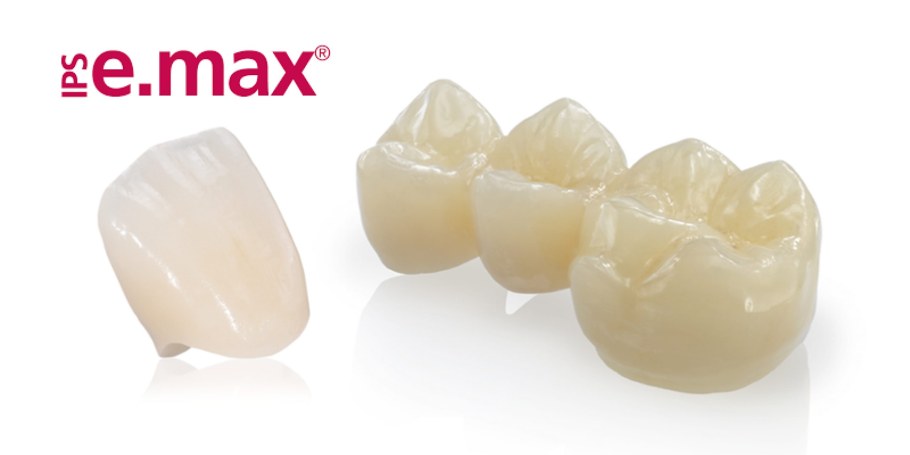 Безметалловая коронка e. Max Press