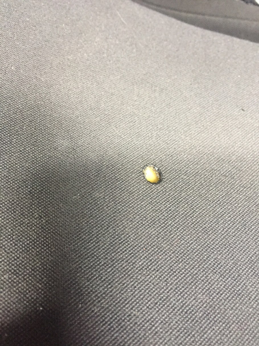 Сиденье прожгло