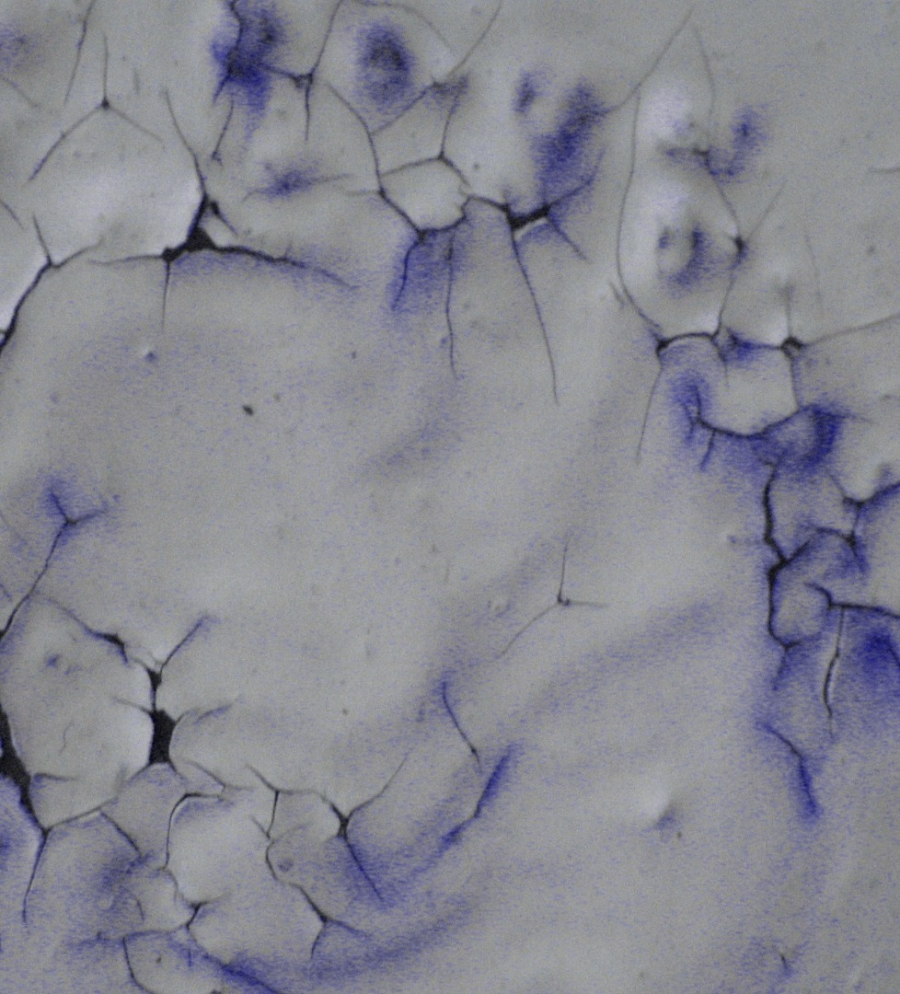 Отслаивание краски